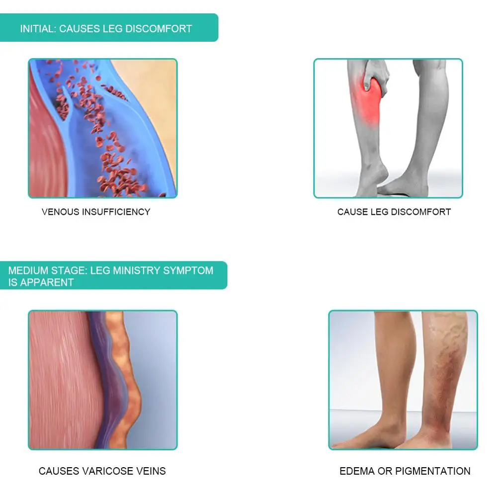 1Pair Medical Compression Sock - Compression Calf Sleeve review and price