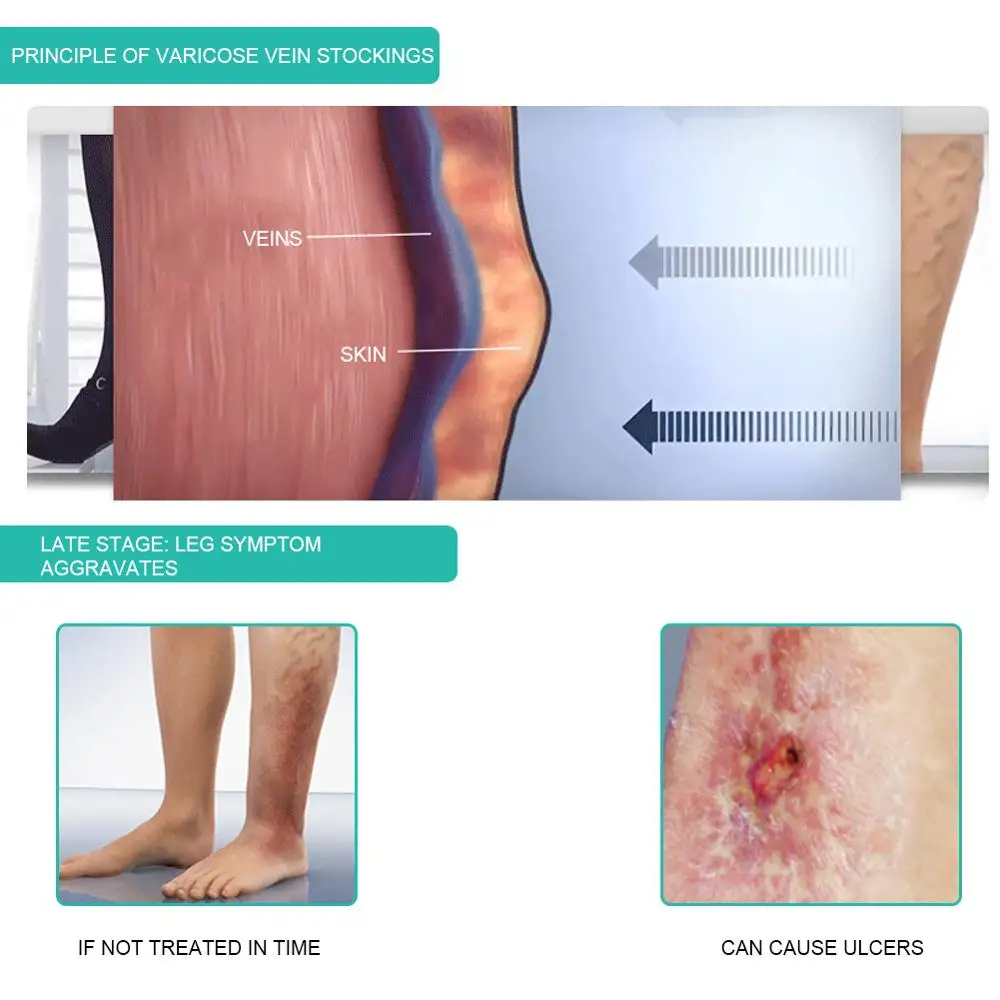 1Pair Medical Compression Sock - Compression Calf Sleeve review and price